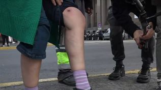 Romina del Plá, denunció esta tarde haber sido víctima de un ataque con balas de goma por parte de la Policía en el Congreso﻿