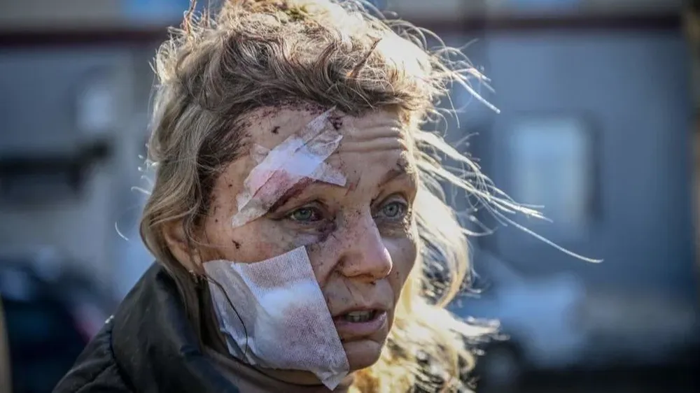 Una mujer que resultó herida por los bombardeos rusos se convirtió en objeto de teorías de conspiración y afirmaciones falsas en internet