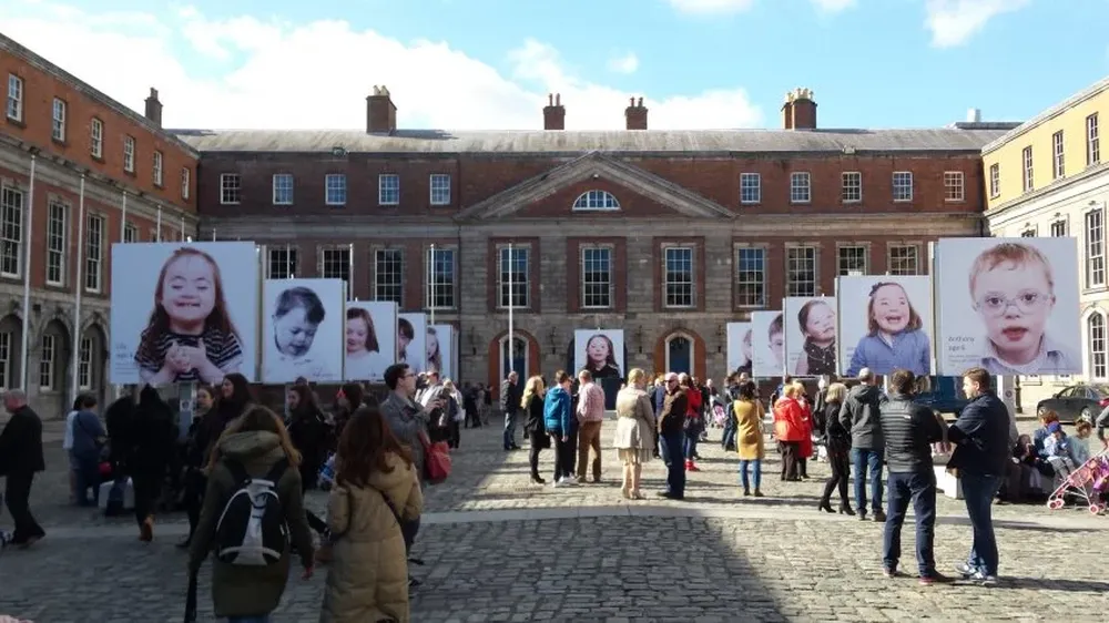 El estudio aún tiene que probarse en niños y no es cura para el síndrome, aclararon los investigadores