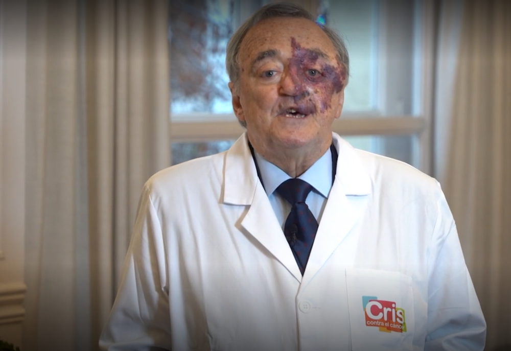 Científicos lograron eliminar el cáncer de páncreas con fármacos.