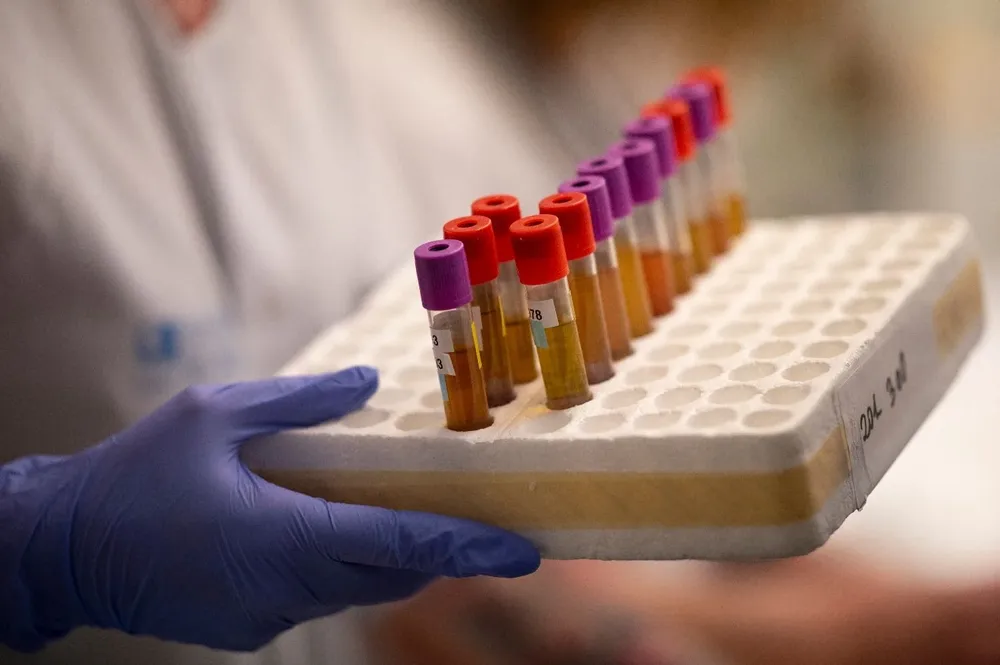 Todos los departamentos tienen casos activos del virus este martes