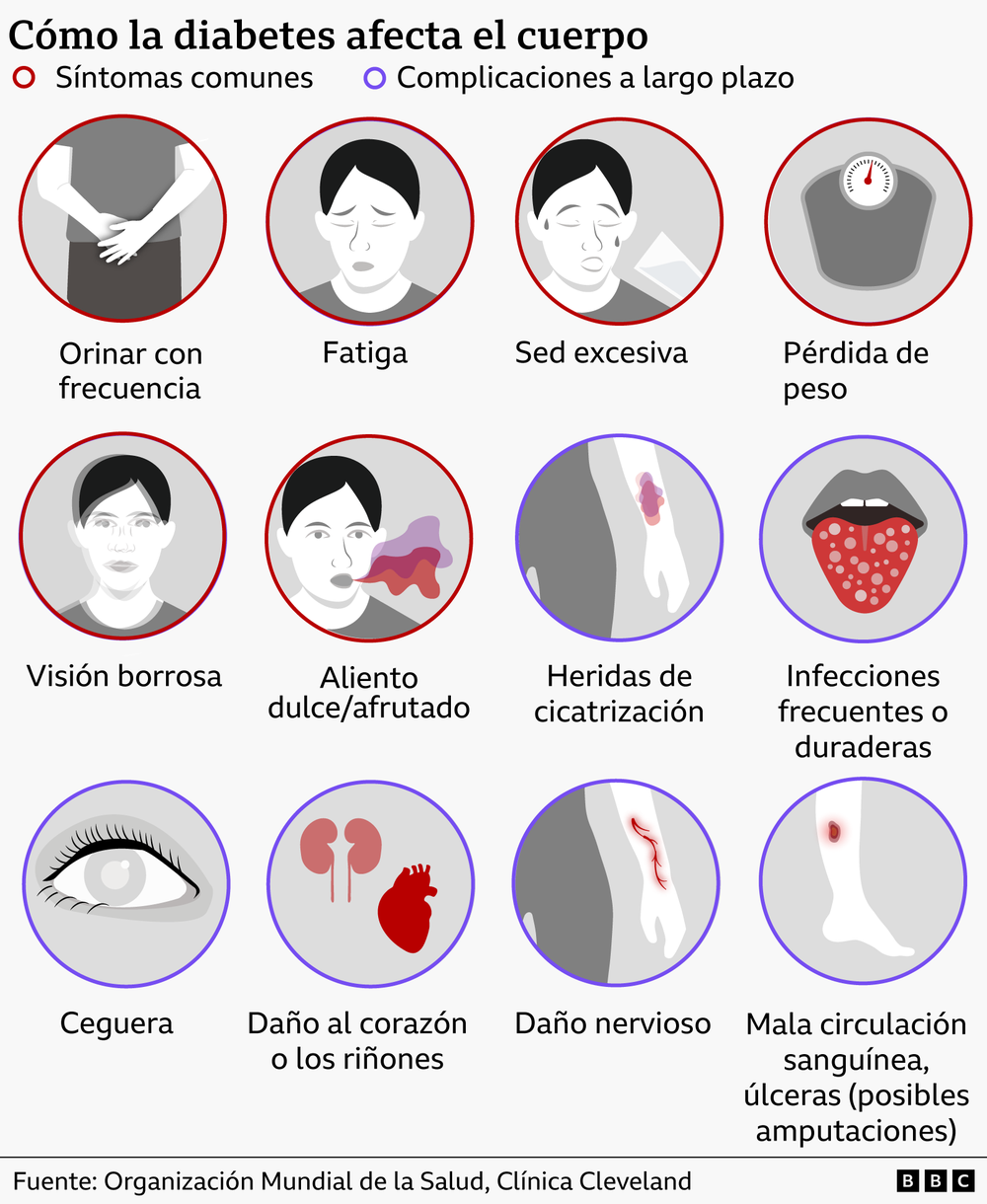 https://www.bbc.com/mundo/articles/cwy20r7r7g9o