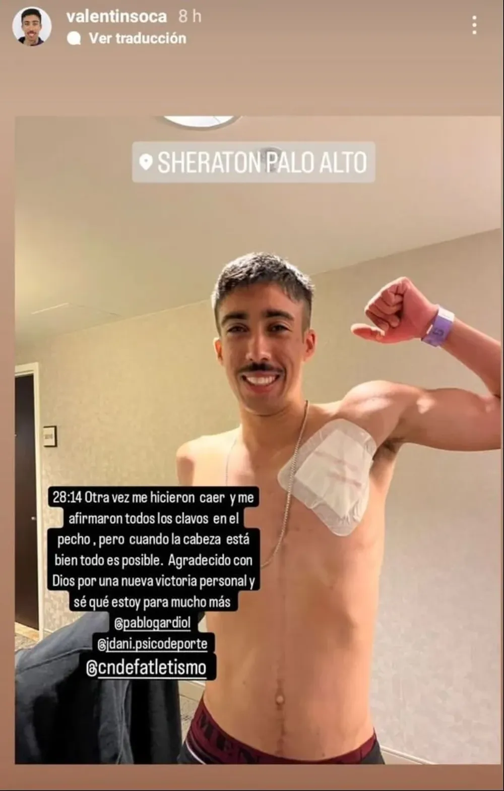 Así quedó Valentín Soca tras caer y ser pisado