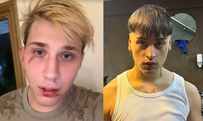 El streamer Brunenger denunció haber sido golpeado por Tiago PZK en un boliche: las versiones de ambos