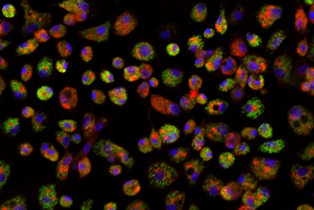 Imagen microscópica de células de mosquito infectadas con el virus dengue.