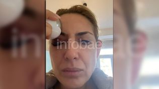 Un video y una foto de un moretón en el ojo, las nuevas pruebas que presentó Yañez para respaldar su denuncia contra Alberto Fernández