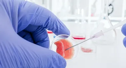 El Observador | 1687805062944.webp