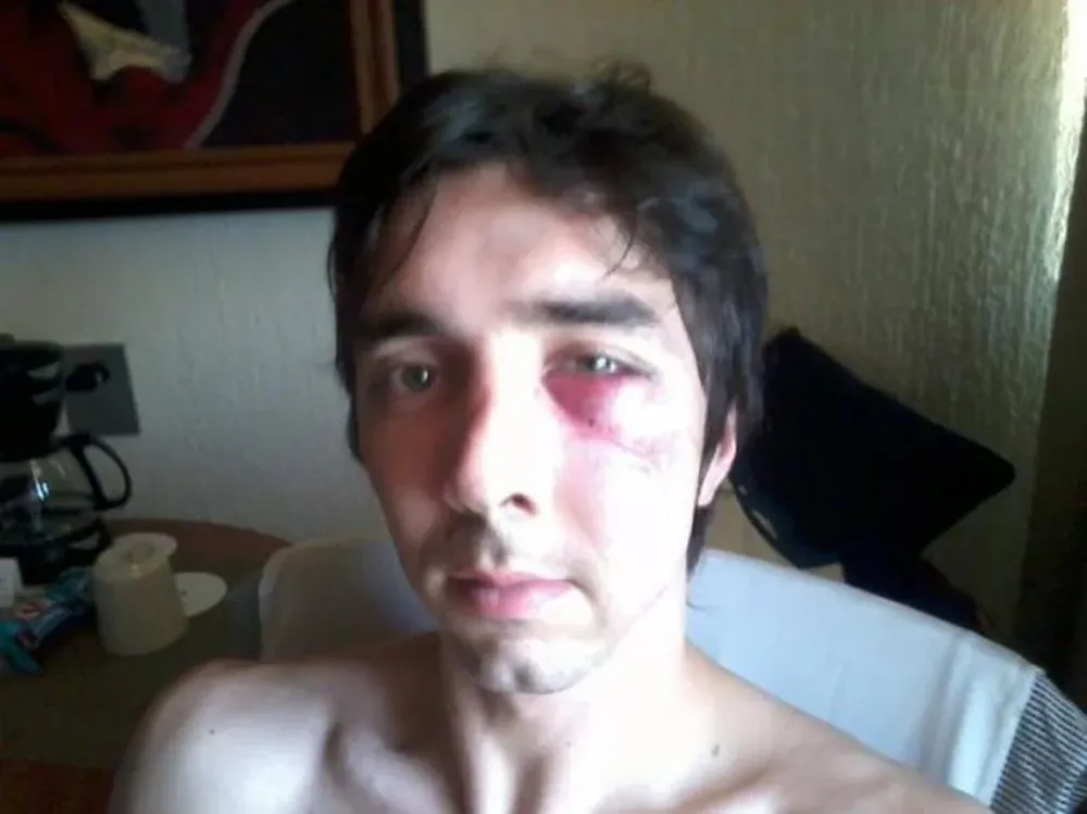 Así jugó Dufau fracturado