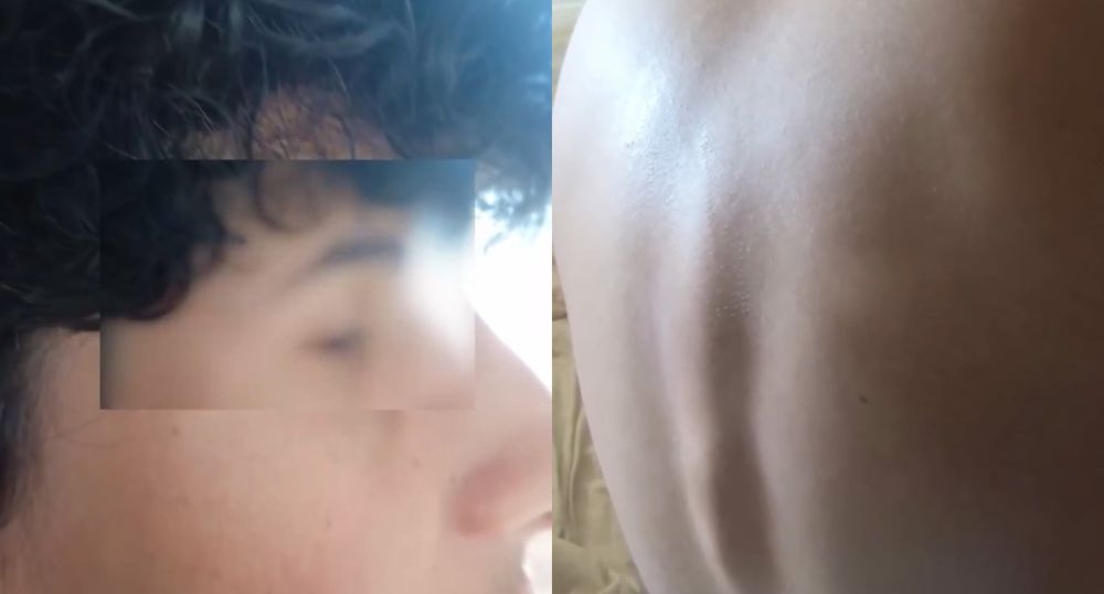 Heridas