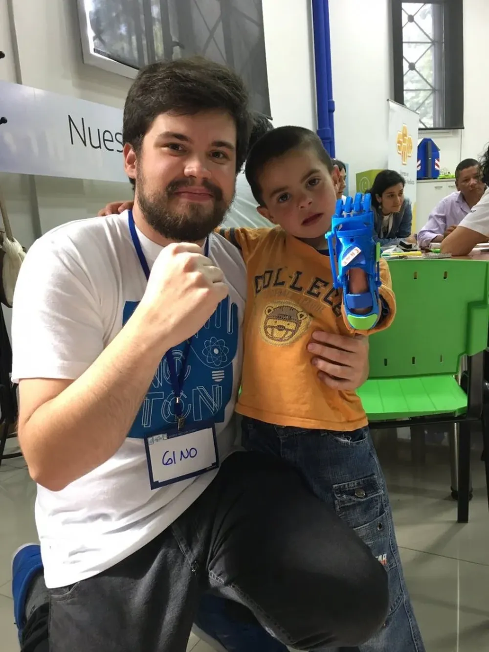 Washington Sebastián muestra orgulloso su prótesis