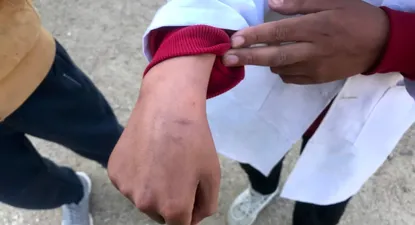 Uno de los escolares que se cortó con el sacapuntas en Barros Blancos.