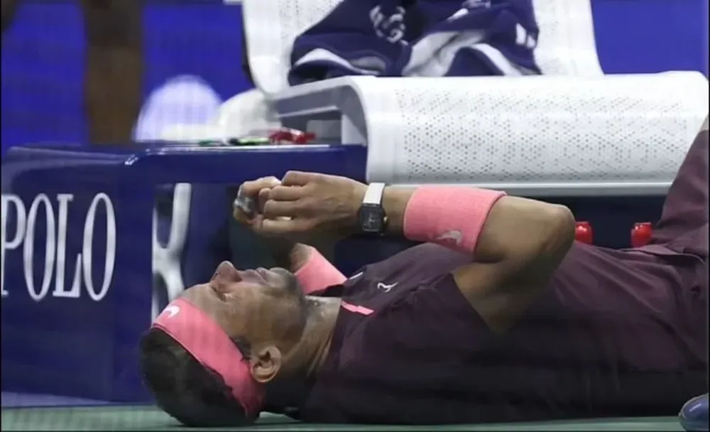 Así quedó la nariz de Nadal