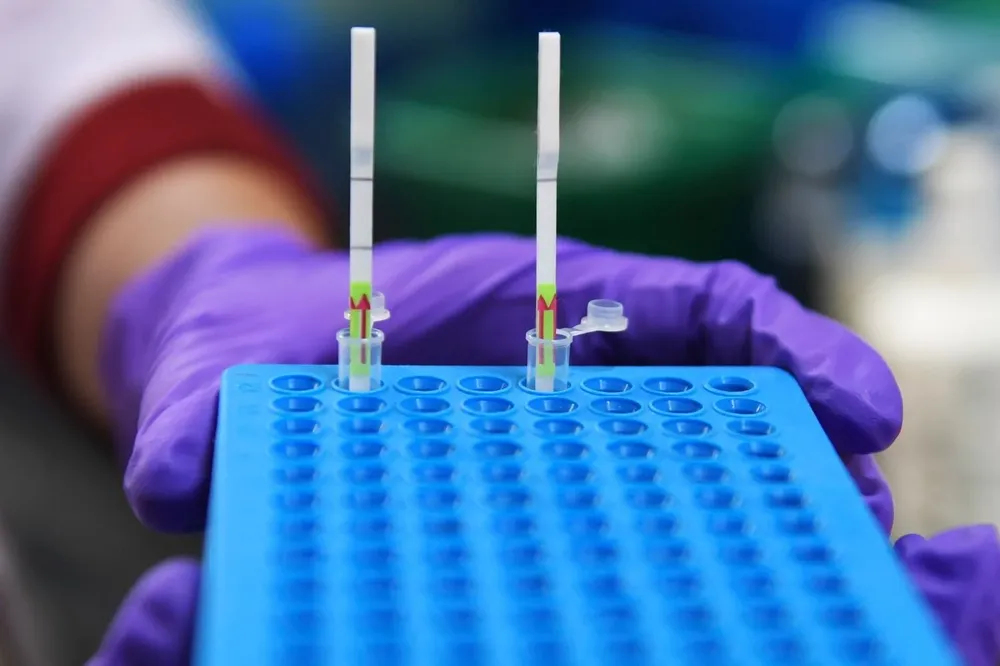 Todos los departamentos tienen casos activos del virus este miércoles