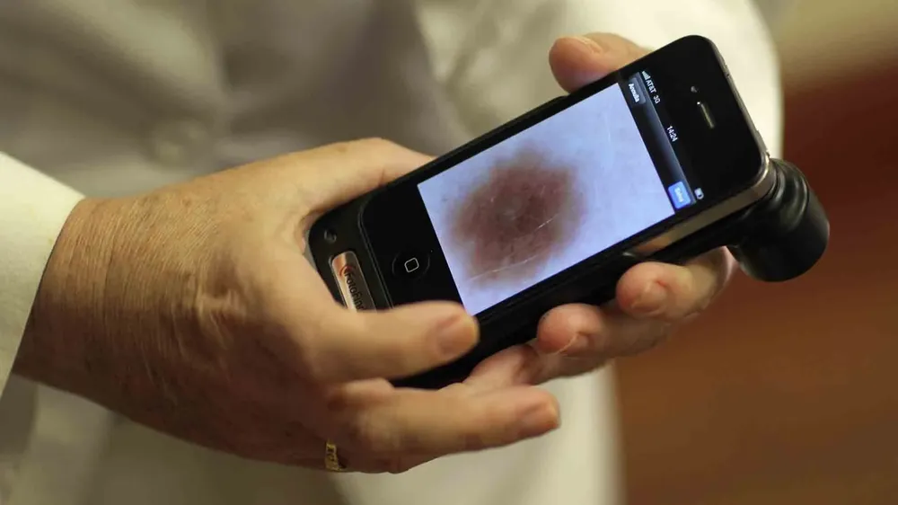 El estudio analizó la efectividad para el diagnóstico médico de cuatro aplicaciones sobre cáncer de piel cuyos nombres no fueron revelados