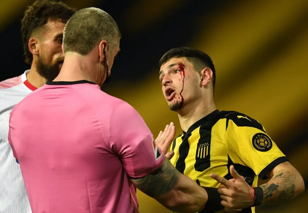 El último clásico que jugó el Canario Álvarez en la vuelta por la Sudamericana