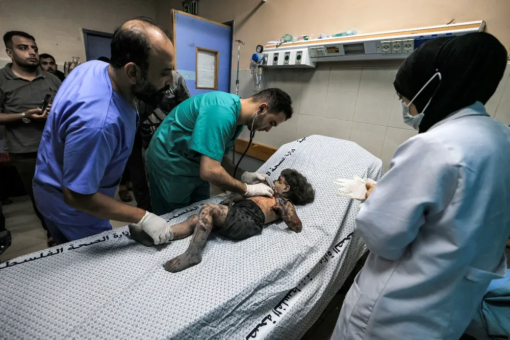 Un niño es atendido en un hospital de Gaza