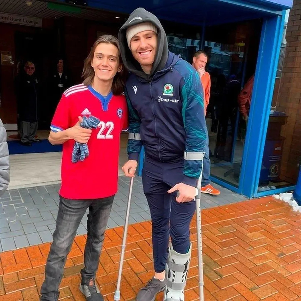 Ben Brereton se tomó una fotografía este sábado en Inglaterra con un hincha chileno y se pueden ver las muletas y cómo le cuidan el tobillo izquierdo