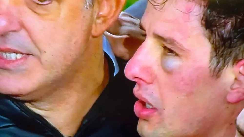 Así le quedó el ojo al árbitro