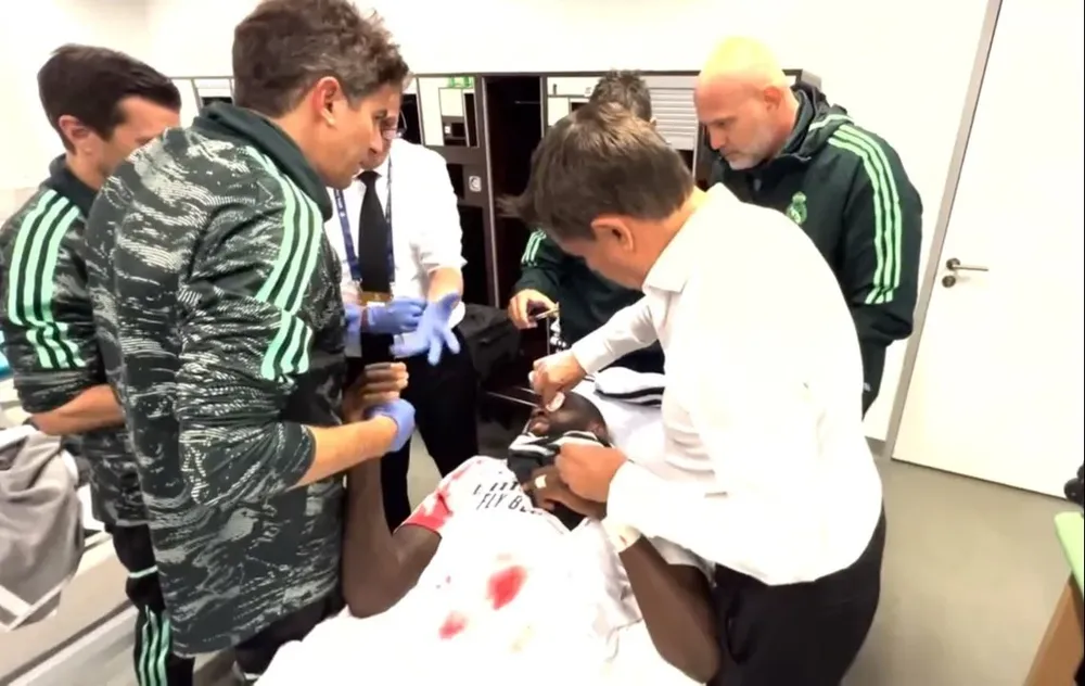 El impactante video de la sutura de Rudiger que subió Real Madrid