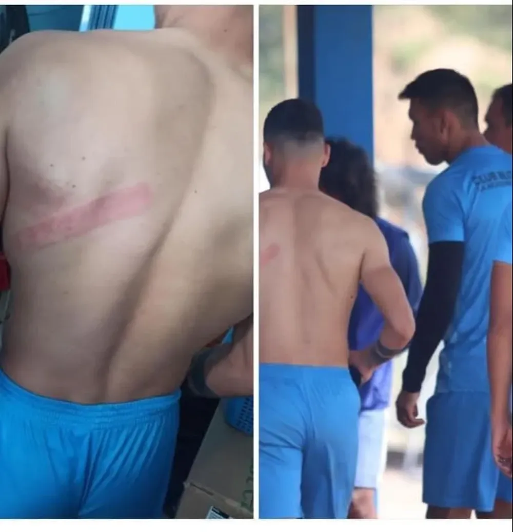 La espalda de Fernando Arismendi