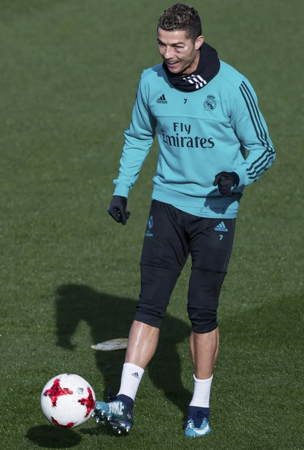 Ronaldo con el corte en su rostro