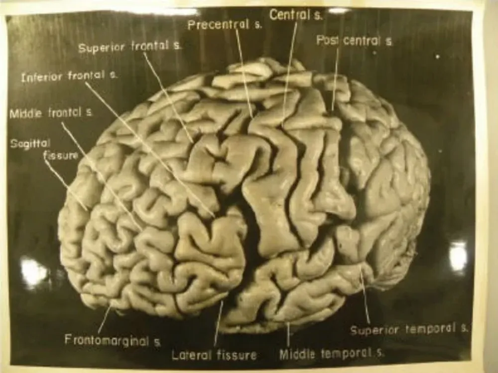 El cerebro de Albert Einstein