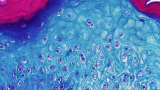 Virus de la mpox o viruela del mono en un microscopio