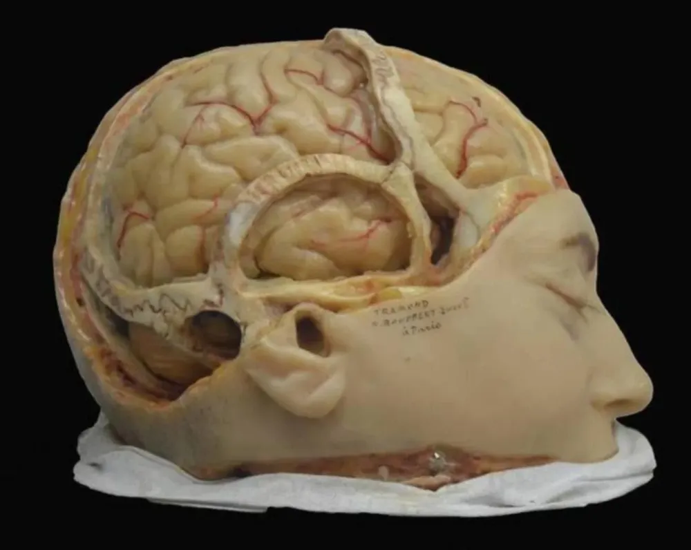 Un análisis de qué otras inteligencias existen.