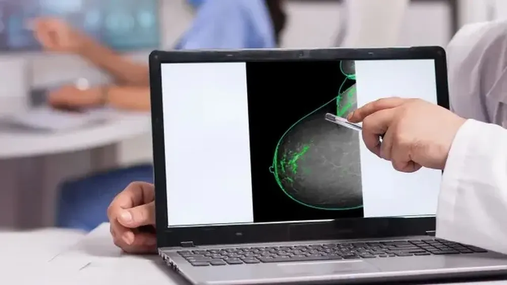 Investigación del cáncer de mama