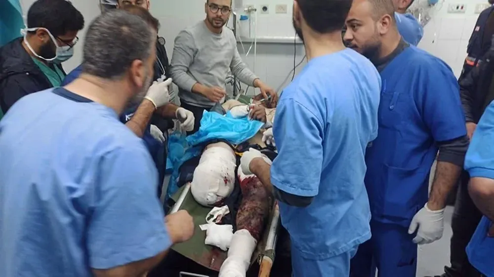 El periodista Ismail Abu Omar debió sufrir la amputación de una pierna y su estado es muy grave, según los médicos del hospital donde es atendido.