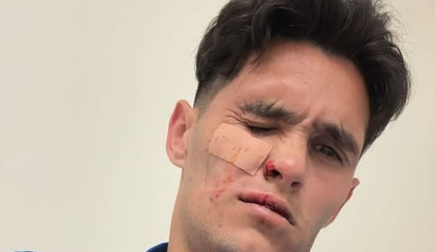 Las impactantes fotos de Ruben Bentancourt tras los cortes que sufrió por un zapataz