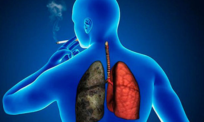 El cáncer de pulmón es la principal causa de fallecimiento por enfermedad entre los españoles.