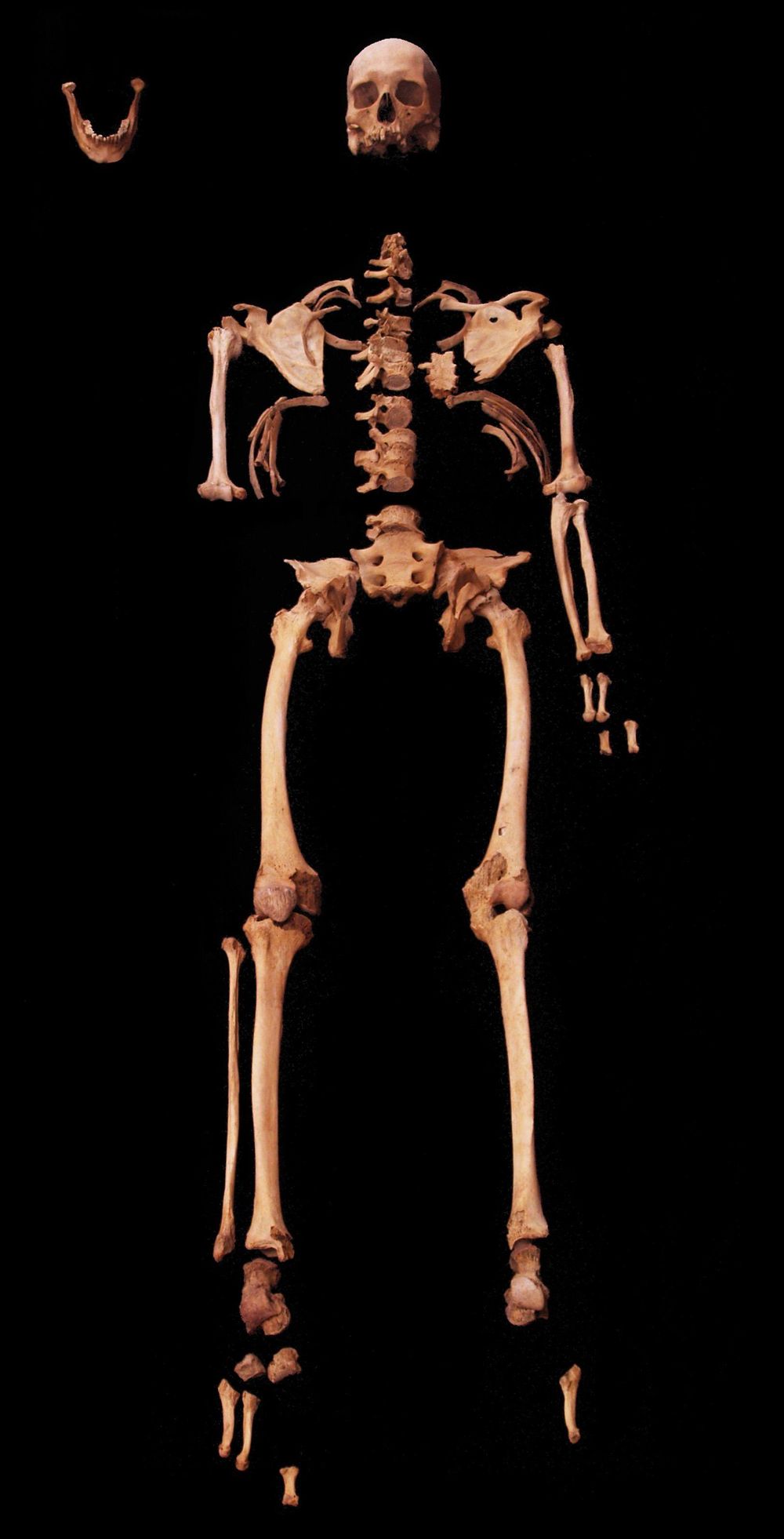 El esqueleto ha revelado detalles extraordinarios sobre la vida del hombre.