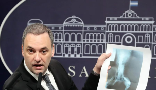 Manuel Adorni mostró la radiografía de un perro que se usó para una pensión por invalidez.