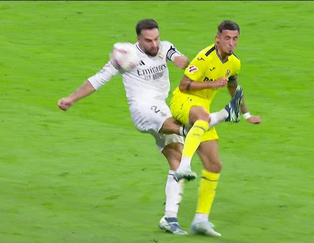 Lesión de Dani Carvajal. Lesión de Dani Carvajal.