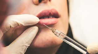 La experiencia del médico es fundamental para evitar desequilibrios faciales al aplicar botox.  