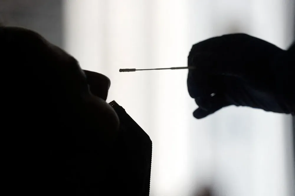 El documento agrega que desde el inicio de la pandemia y hasta el 19 de enero pasado se notificaron un total de 753 millones de contagios y más de 6,8 millones de muertes.