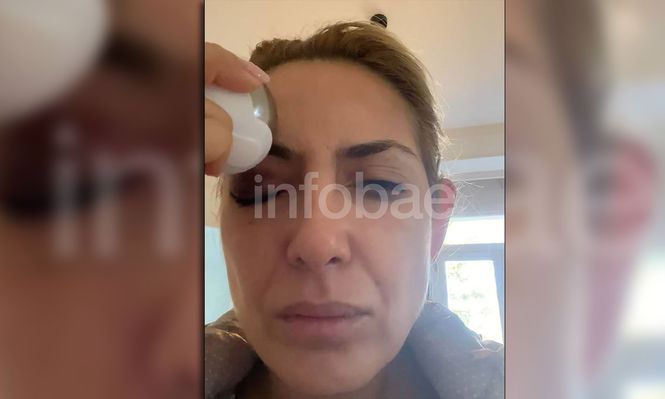 Un video y una foto de un moretón en el ojo, las nuevas pruebas que presentó Yañez para respaldar su denuncia contra Alberto Fernández