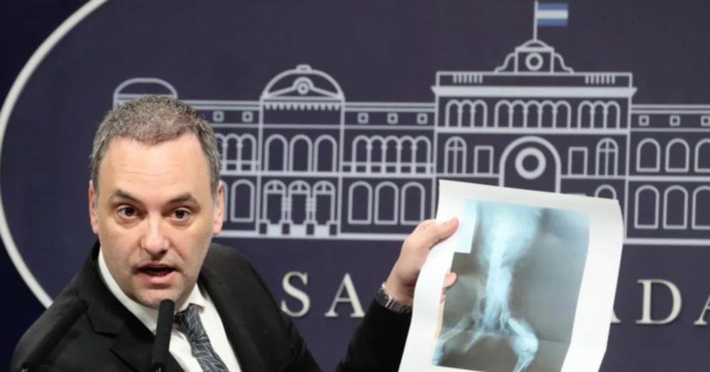 Manuel Adorni mostró la radiografía de un perro que se usó para una pensión por invalidez.