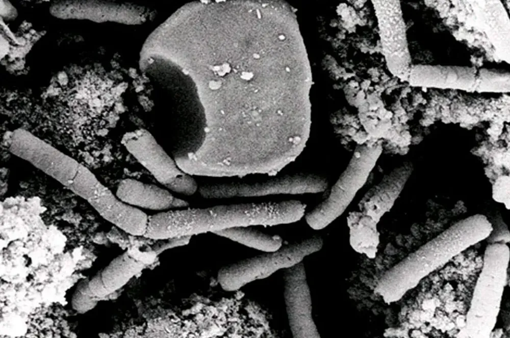 La bacteria del ántrax