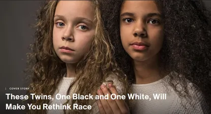 Una melliza blanca y otra negra: las niñas que desafían los preconceptos racistas