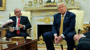 Algunos periodistas notaron morados en las manos del presidente durante la visita del Primer Ministro de Bahrein a la Casa Blanca.