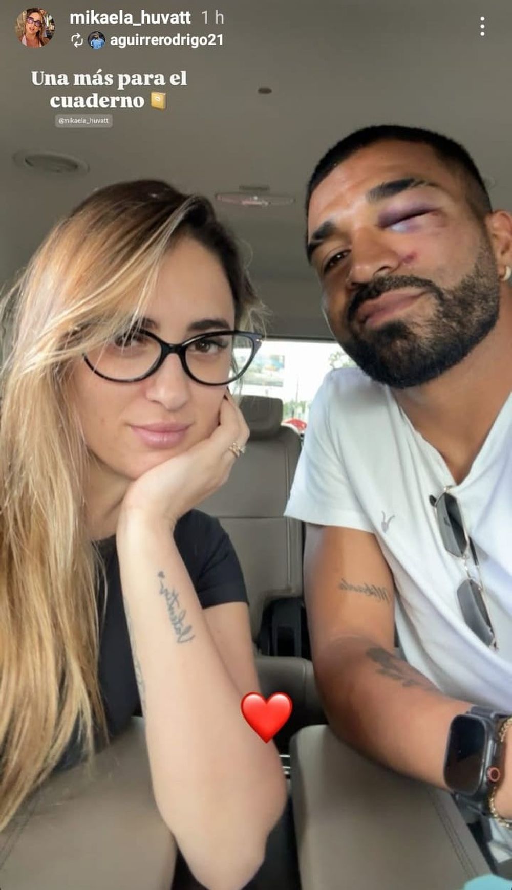 La foto de Mikaela Huvatt junto a Rodrigo Aguirre tras su duro golpe 