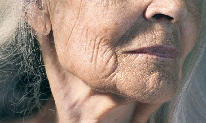 Curar quemaduras y heridas sin cicatrices, eliminar la calvice y hasta retrasar los signos del envejecimiento... algunos de los usos potenciales de este descubrimiento.