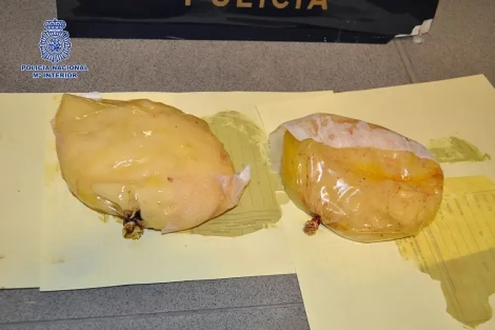 Imagen facilitada por la Policía con las prótesis mamarias de cocaína