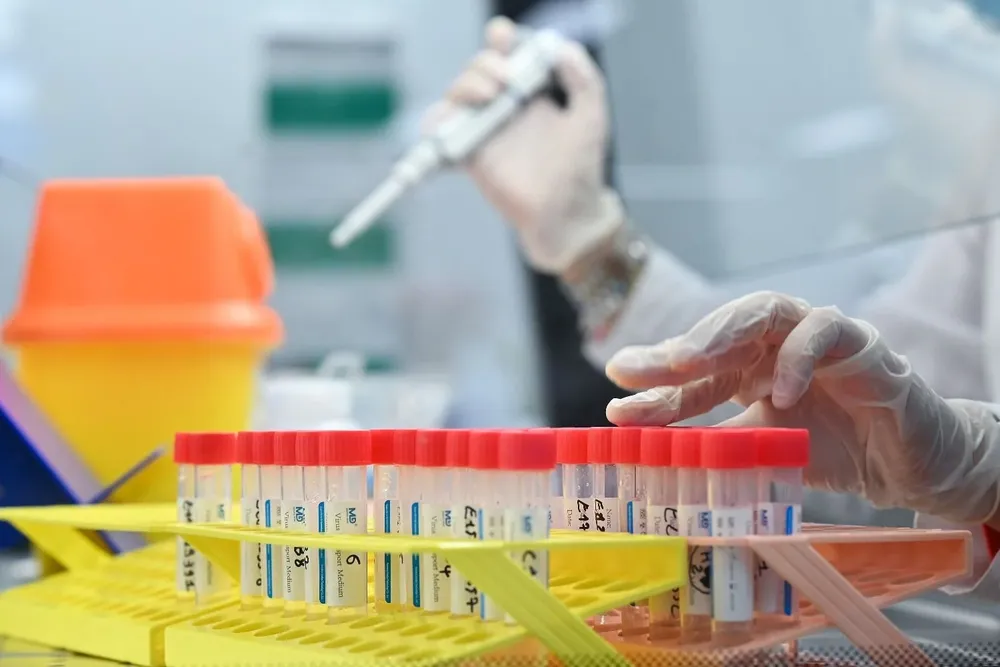 Los estudios PCR se analizan en laboratorios para detectar la presencia de coronavirus en las muestras