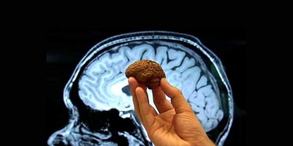 Además de la memoria, el chocolate negro tiene otros beneficios para la salud. 