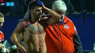 Así terminó un jugador de Lavalleja tras el título de San José por la Copa Nacional de Selecciones de OFI