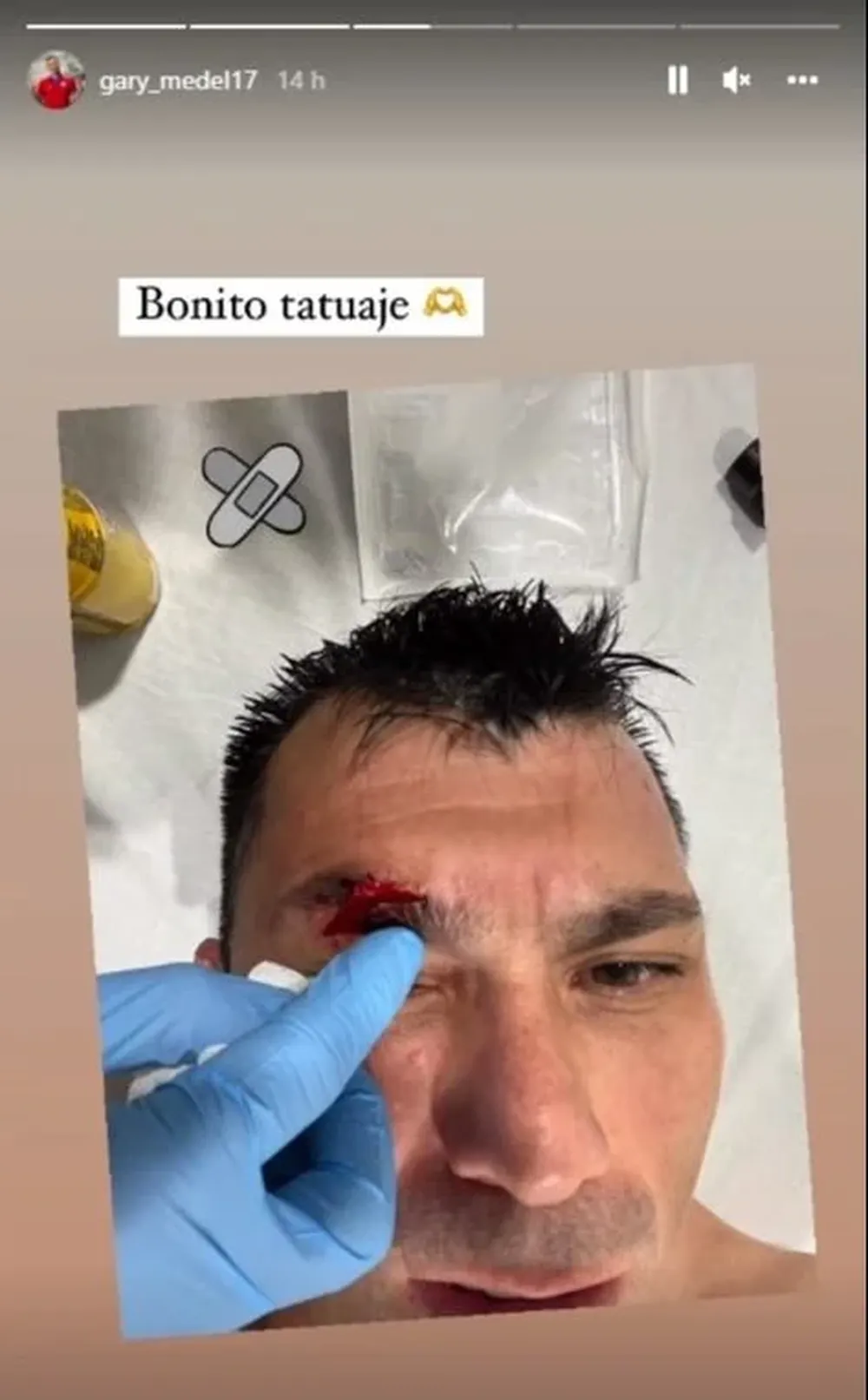 La foto que subió Medel