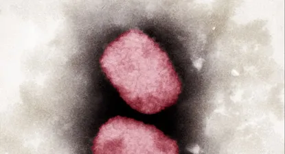 La viruela del mono en el microscópio